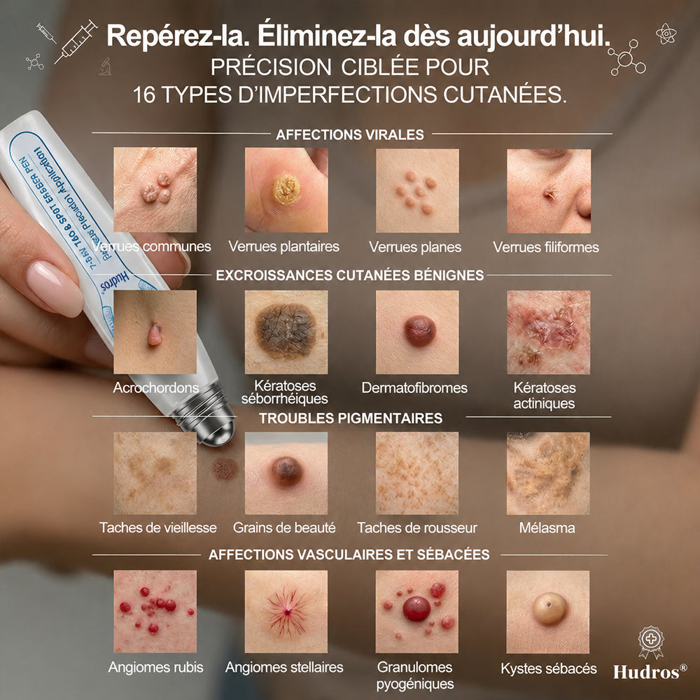 Boutique officielle de la marque🔥 | Hudros® 7 Jours Effaceur de taches et d’excroissances cutanées (Zéro douleur, zéro cicatrice – Roller)