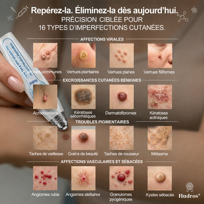 Boutique officielle de la marque🔥 | Hudros® 7 Jours Effaceur de taches et d’excroissances cutanées (Zéro douleur, zéro cicatrice – Roller)