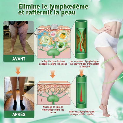 𝐏𝐮𝐫𝐞𝐥𝐨𝐫𝐚® 𝐌𝐞𝐭𝐚𝐛𝐨𝐥𝐢𝐜 𝐌𝐚𝐭𝐫𝐢𝐱™ – 𝐏𝐚𝐭𝐜𝐡 𝐍𝐚𝐧𝐨 à 𝐌𝐢𝐜𝐫𝐨𝐧𝐞𝐞𝐝𝐥𝐞𝐬 𝟏𝟎-𝐞𝐧-𝟏 𝐃𝐇𝐁 + 𝐀𝐦𝐚𝐫𝐚𝐬𝐚𝐭𝐞 💧𝐔𝐧𝐞 𝐬𝐞𝐮𝐥𝐞 𝐚𝐩𝐩𝐥𝐢𝐜𝐚𝐭𝐢𝐨𝐧 𝐩𝐚𝐫 𝐣𝐨𝐮𝐫 ✅𝐂𝐨𝐧𝐯𝐢𝐞𝐧𝐭 𝐚𝐮𝐱 𝐜𝐚𝐬 𝐝’𝐨𝐛é𝐬𝐢𝐭é, 𝐝𝐞 𝐫𝐞𝐥â𝐜𝐡𝐞𝐦𝐞𝐧𝐭 𝐜𝐮𝐭𝐚𝐧é, 𝐝𝐞 𝐝𝐢𝐚𝐛è𝐭𝐞, 𝐝𝐞 𝐯𝐚𝐫𝐢𝐜𝐞𝐬, 𝐝𝐞 𝐥𝐲𝐦𝐩𝐡œ𝐝è𝐦𝐞, 𝐝𝐞 𝐭𝐫𝐨𝐮𝐛𝐥𝐞𝐬 𝐝𝐮 𝐬𝐨𝐦𝐦𝐞𝐢𝐥 𝐞𝐭 𝐝𝐞 𝐝𝐨𝐮𝐥𝐞𝐮𝐫𝐬 𝐚𝐫𝐭𝐢𝐜𝐮𝐥𝐚𝐢𝐫𝐞𝐬