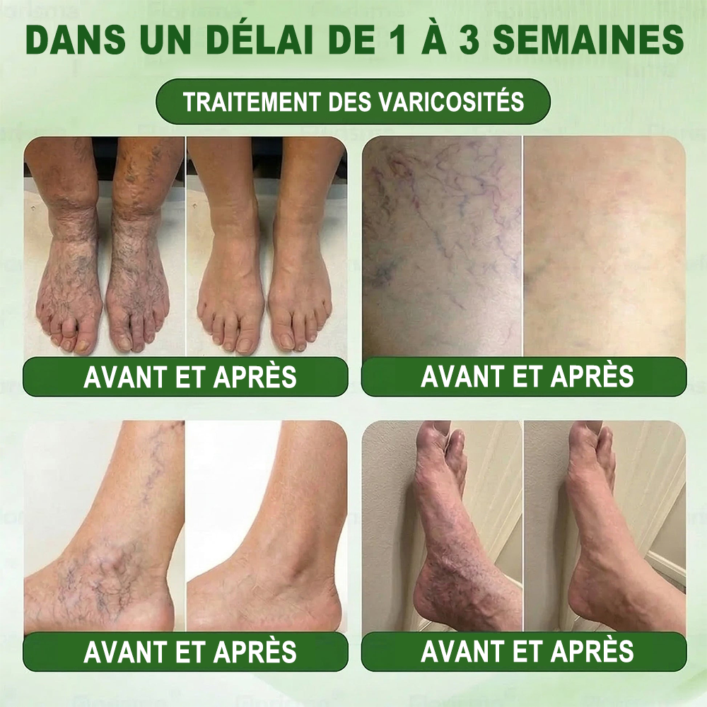 𝐏𝐮𝐫𝐞𝐥𝐨𝐫𝐚® 𝐌𝐞𝐭𝐚𝐛𝐨𝐥𝐢𝐜 𝐌𝐚𝐭𝐫𝐢𝐱™ – 𝐏𝐚𝐭𝐜𝐡 𝐍𝐚𝐧𝐨 à 𝐌𝐢𝐜𝐫𝐨𝐧𝐞𝐞𝐝𝐥𝐞𝐬 𝟏𝟎-𝐞𝐧-𝟏 𝐃𝐇𝐁 + 𝐀𝐦𝐚𝐫𝐚𝐬𝐚𝐭𝐞 💧𝐔𝐧𝐞 𝐬𝐞𝐮𝐥𝐞 𝐚𝐩𝐩𝐥𝐢𝐜𝐚𝐭𝐢𝐨𝐧 𝐩𝐚𝐫 𝐣𝐨𝐮𝐫 ✅𝐂𝐨𝐧𝐯𝐢𝐞𝐧𝐭 𝐚𝐮𝐱 𝐜𝐚𝐬 𝐝’𝐨𝐛é𝐬𝐢𝐭é, 𝐝𝐞 𝐫𝐞𝐥â𝐜𝐡𝐞𝐦𝐞𝐧𝐭 𝐜𝐮𝐭𝐚𝐧é, 𝐝𝐞 𝐝𝐢𝐚𝐛è𝐭𝐞, 𝐝𝐞 𝐯𝐚𝐫𝐢𝐜𝐞𝐬, 𝐝𝐞 𝐥𝐲𝐦𝐩𝐡œ𝐝è𝐦𝐞, 𝐝𝐞 𝐭𝐫𝐨𝐮𝐛𝐥𝐞𝐬 𝐝𝐮 𝐬𝐨𝐦𝐦𝐞𝐢𝐥 𝐞𝐭 𝐝𝐞 𝐝𝐨𝐮𝐥𝐞𝐮𝐫𝐬 𝐚𝐫𝐭𝐢𝐜𝐮𝐥𝐚𝐢𝐫𝐞𝐬