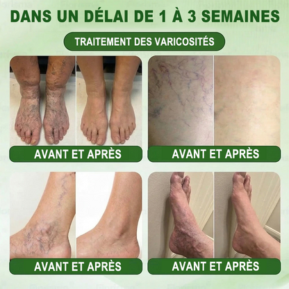 𝐏𝐮𝐫𝐞𝐥𝐨𝐫𝐚® 𝐌𝐞𝐭𝐚𝐛𝐨𝐥𝐢𝐜 𝐌𝐚𝐭𝐫𝐢𝐱™ – 𝐏𝐚𝐭𝐜𝐡 𝐍𝐚𝐧𝐨 à 𝐌𝐢𝐜𝐫𝐨𝐧𝐞𝐞𝐝𝐥𝐞𝐬 𝟏𝟎-𝐞𝐧-𝟏 𝐃𝐇𝐁 + 𝐀𝐦𝐚𝐫𝐚𝐬𝐚𝐭𝐞 💧𝐔𝐧𝐞 𝐬𝐞𝐮𝐥𝐞 𝐚𝐩𝐩𝐥𝐢𝐜𝐚𝐭𝐢𝐨𝐧 𝐩𝐚𝐫 𝐣𝐨𝐮𝐫 ✅𝐂𝐨𝐧𝐯𝐢𝐞𝐧𝐭 𝐚𝐮𝐱 𝐜𝐚𝐬 𝐝’𝐨𝐛é𝐬𝐢𝐭é, 𝐝𝐞 𝐫𝐞𝐥â𝐜𝐡𝐞𝐦𝐞𝐧𝐭 𝐜𝐮𝐭𝐚𝐧é, 𝐝𝐞 𝐝𝐢𝐚𝐛è𝐭𝐞, 𝐝𝐞 𝐯𝐚𝐫𝐢𝐜𝐞𝐬, 𝐝𝐞 𝐥𝐲𝐦𝐩𝐡œ𝐝è𝐦𝐞, 𝐝𝐞 𝐭𝐫𝐨𝐮𝐛𝐥𝐞𝐬 𝐝𝐮 𝐬𝐨𝐦𝐦𝐞𝐢𝐥 𝐞𝐭 𝐝𝐞 𝐝𝐨𝐮𝐥𝐞𝐮𝐫𝐬 𝐚𝐫𝐭𝐢𝐜𝐮𝐥𝐚𝐢𝐫𝐞𝐬