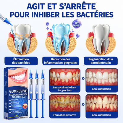 🦷✨ 𝑷𝒖𝒓𝒆𝒍𝒐𝒓𝒂® 𝑮𝒖𝒎𝑹𝒆𝒗𝒊𝒗𝒆 𝑮𝒆𝒍 𝒅𝒆 𝑹é𝒑𝒂𝒓𝒂𝒕𝒊𝒐𝒏 𝑷𝒂𝒓𝒐𝒅𝒐𝒏𝒕𝒂𝒍𝒆