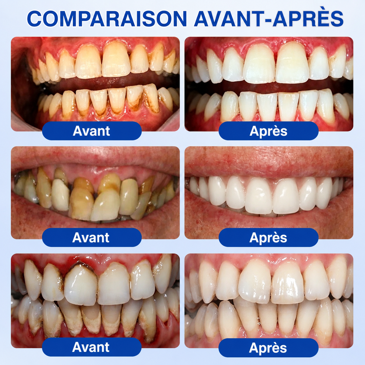 🦷✨ 𝑷𝒖𝒓𝒆𝒍𝒐𝒓𝒂® 𝑮𝒖𝒎𝑹𝒆𝒗𝒊𝒗𝒆 𝑮𝒆𝒍 𝒅𝒆 𝑹é𝒑𝒂𝒓𝒂𝒕𝒊𝒐𝒏 𝑷𝒂𝒓𝒐𝒅𝒐𝒏𝒕𝒂𝒍𝒆
