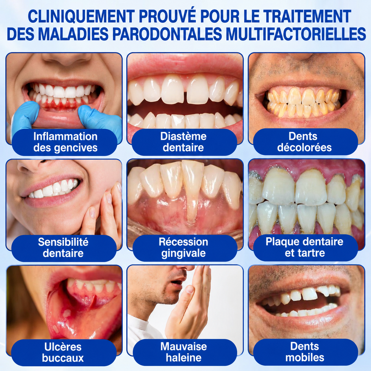 🦷✨ 𝑷𝒖𝒓𝒆𝒍𝒐𝒓𝒂® 𝑮𝒖𝒎𝑹𝒆𝒗𝒊𝒗𝒆 𝑮𝒆𝒍 𝒅𝒆 𝑹é𝒑𝒂𝒓𝒂𝒕𝒊𝒐𝒏 𝑷𝒂𝒓𝒐𝒅𝒐𝒏𝒕𝒂𝒍𝒆