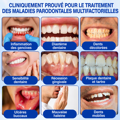 🦷✨ 𝑷𝒖𝒓𝒆𝒍𝒐𝒓𝒂® 𝑮𝒖𝒎𝑹𝒆𝒗𝒊𝒗𝒆 𝑮𝒆𝒍 𝒅𝒆 𝑹é𝒑𝒂𝒓𝒂𝒕𝒊𝒐𝒏 𝑷𝒂𝒓𝒐𝒅𝒐𝒏𝒕𝒂𝒍𝒆